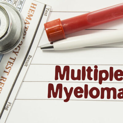 Emerging Treatments for Multiple Myeloma