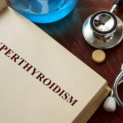 Hyperthyroidism Treatment Methods