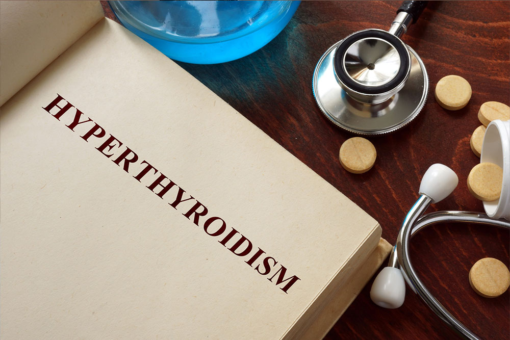 Hyperthyroidism Treatment Methods