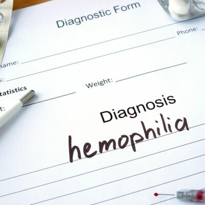 Steps to Manage Hemophilia