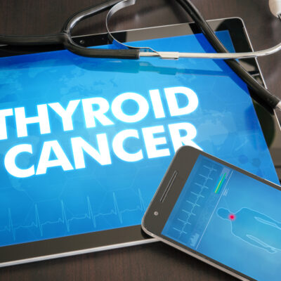 Thyroid Cancer: Types, Diagnosis, and Treatment