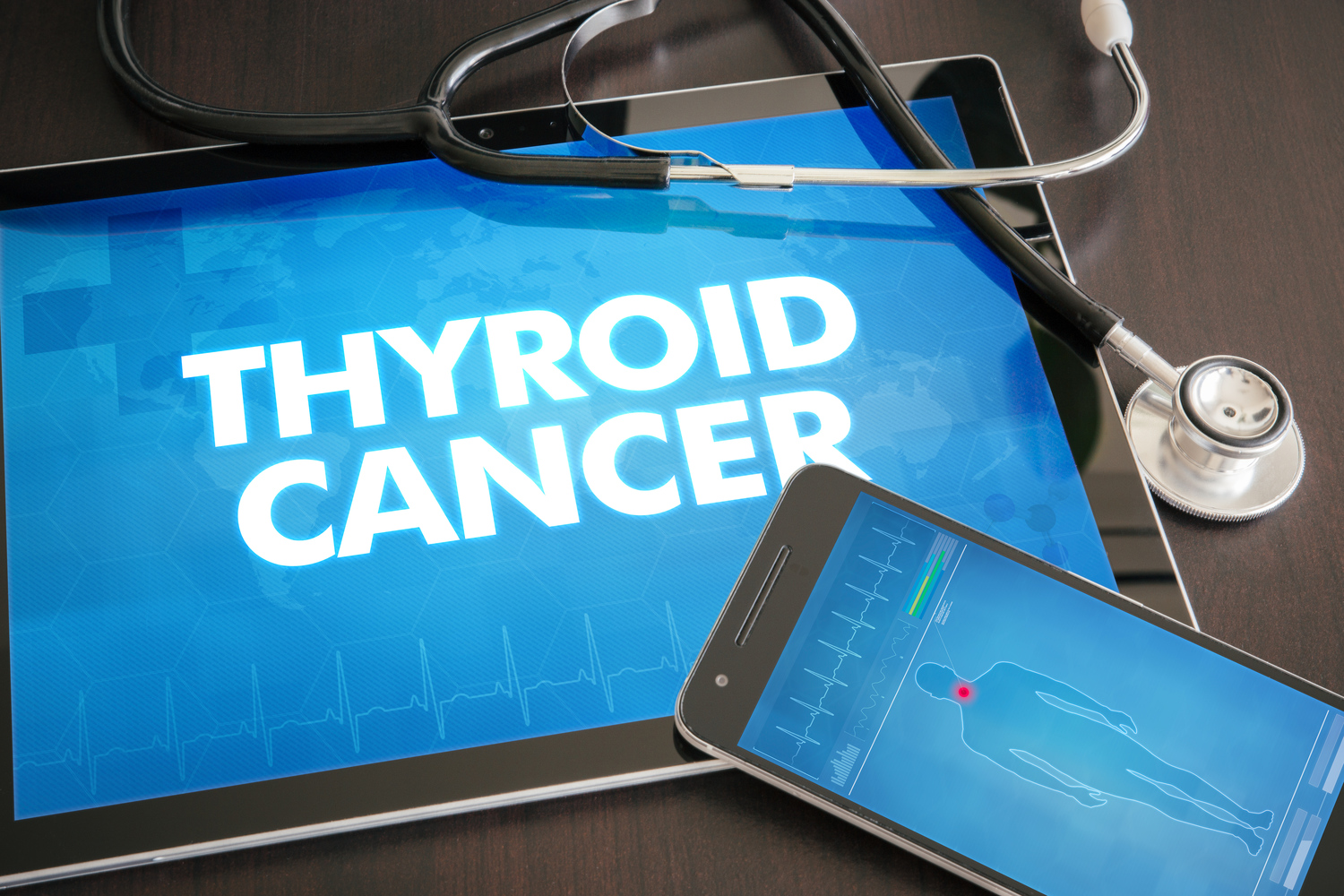 Thyroid Cancer: Types, Diagnosis, and Treatment