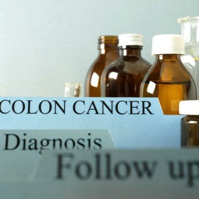 Colon Cancer: The Causes, Symptoms, Risk Factors, and Treatments