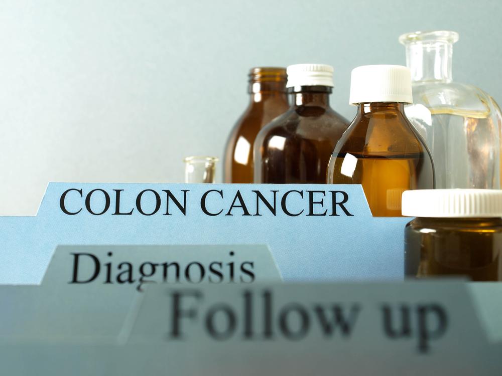 Colon Cancer: The Causes, Symptoms, Risk Factors, and Treatments