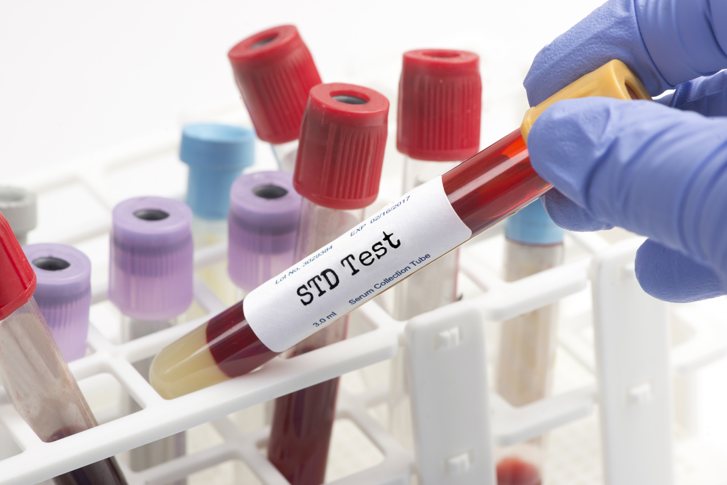 The Benefits of Using an At-Home STD Testing Kit