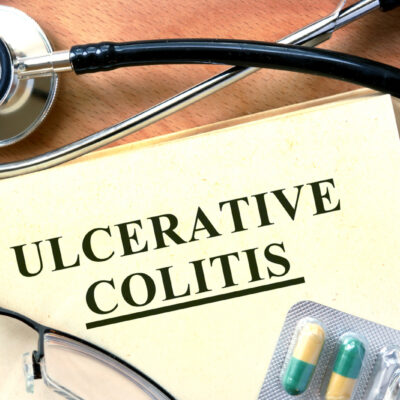 Foods to Avoid for Colitis