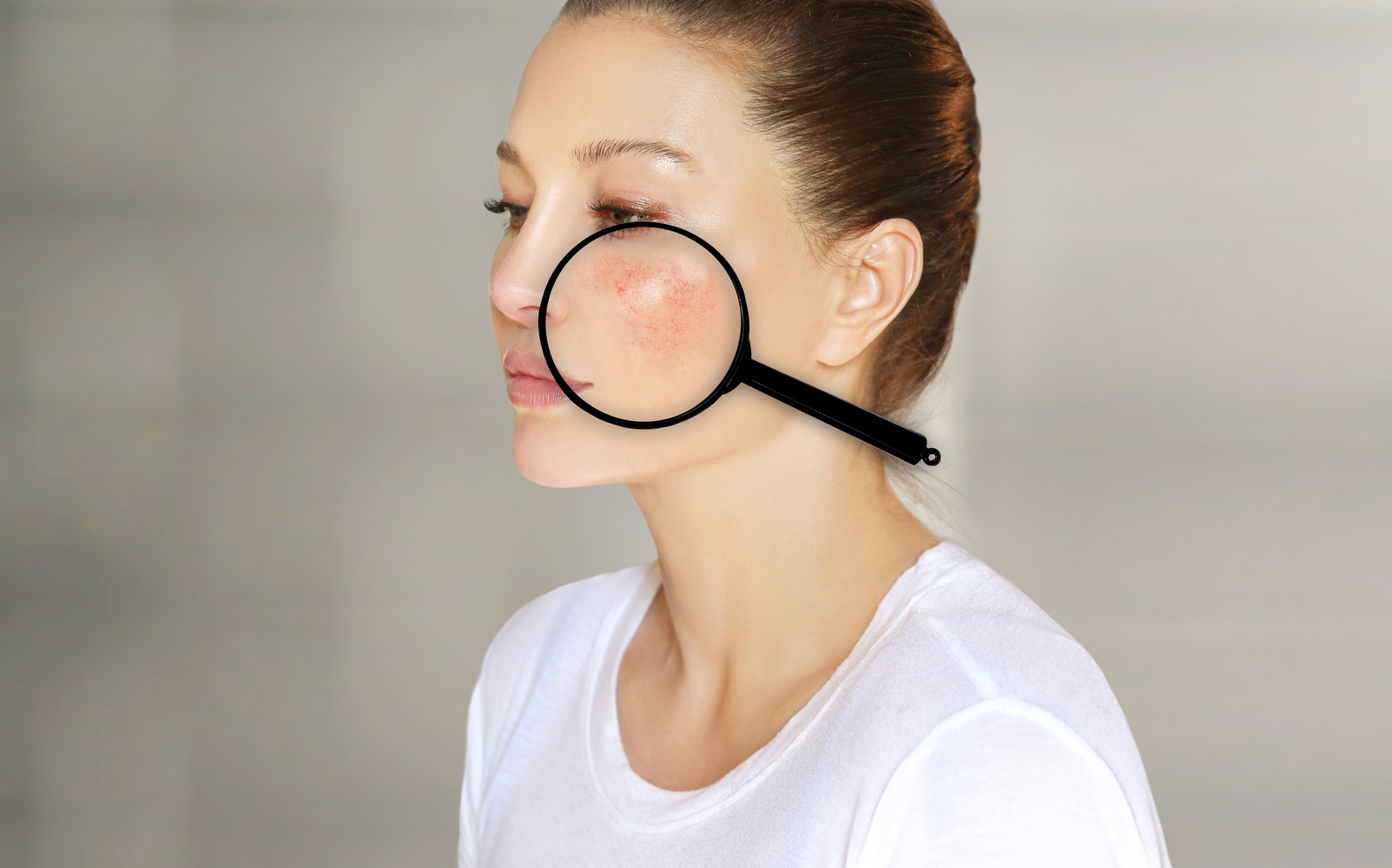 Early Warning Signs of Lupus
