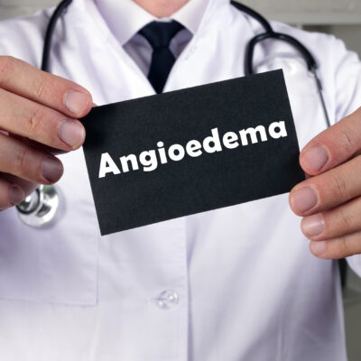 Foods That Trigger Hereditary Angioedema (HAE)