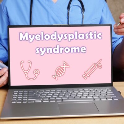 Foods to Avoid for Myelodysplastic Syndrome