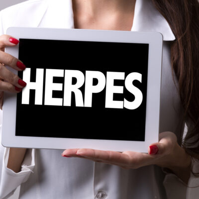 Silent signs and symptoms of herpes